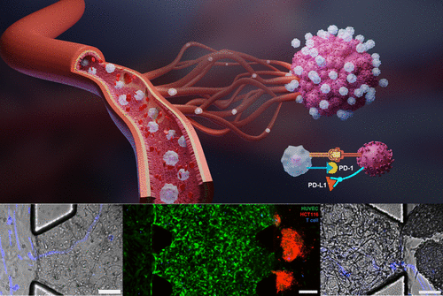 Microphysiologically engineered vessel-tumor model